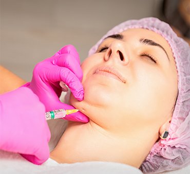 HIFU technique facial skin chin treatment